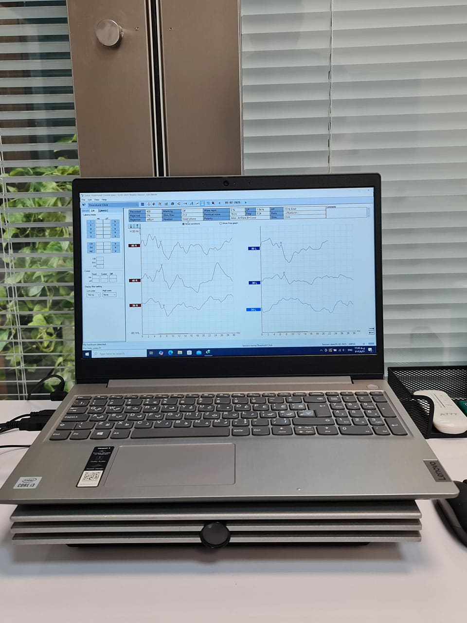 کلینیک شنوایی و سمعک ایران