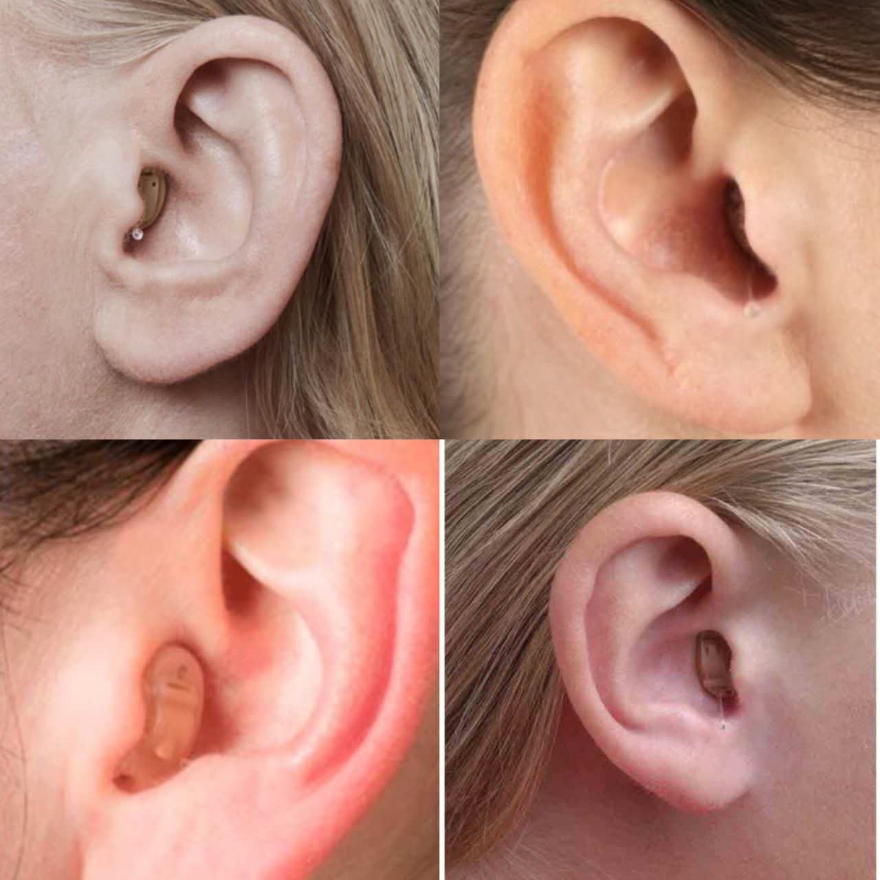 سمعک نامرئی چیست؟ بررسی مزایا و معایب سمعک‌های نامرئی